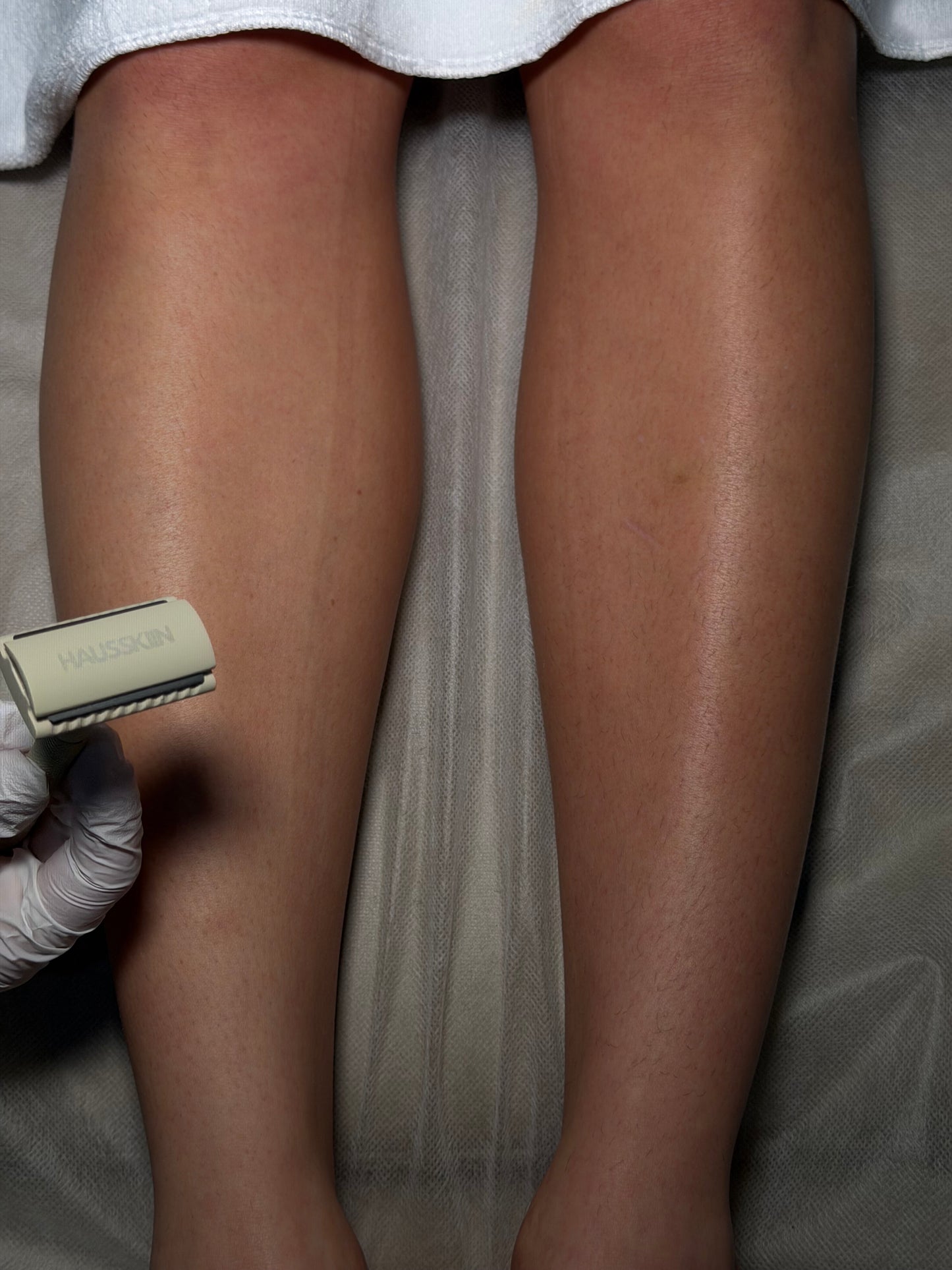Body Razor Hausskiin